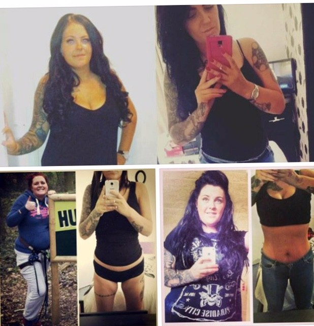 Laser Lipo