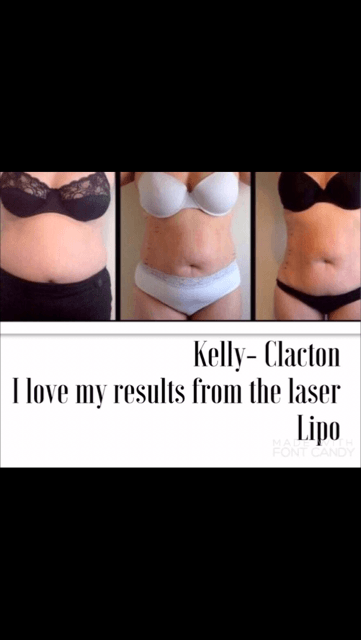 Lipo 3